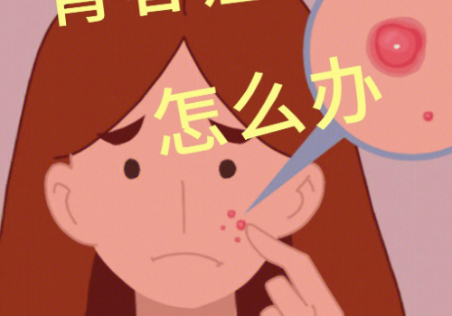 青春痘诊疗方法，技术优势有什么？
